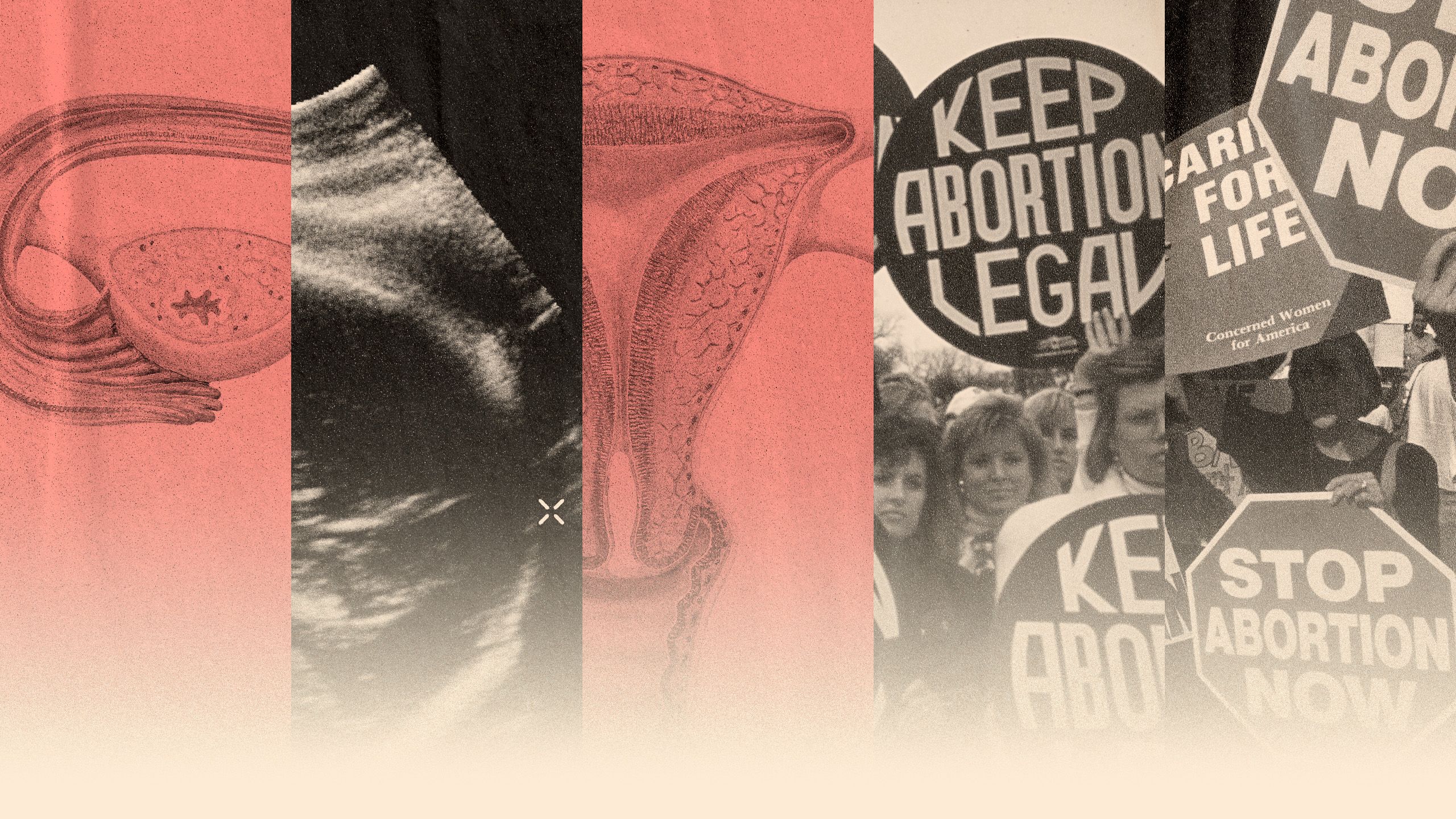 Photo illustration of a woman's reproductive system diagram, a sonogram image, abortion rights and anti-abortion protests.